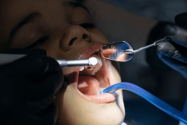 incrustacion-dental-precio-en-cuernavaca.png
